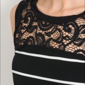 Tops - Striped Ruched Lace Top Tops - Striped Ruched Lace Top